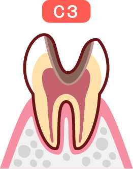 C3